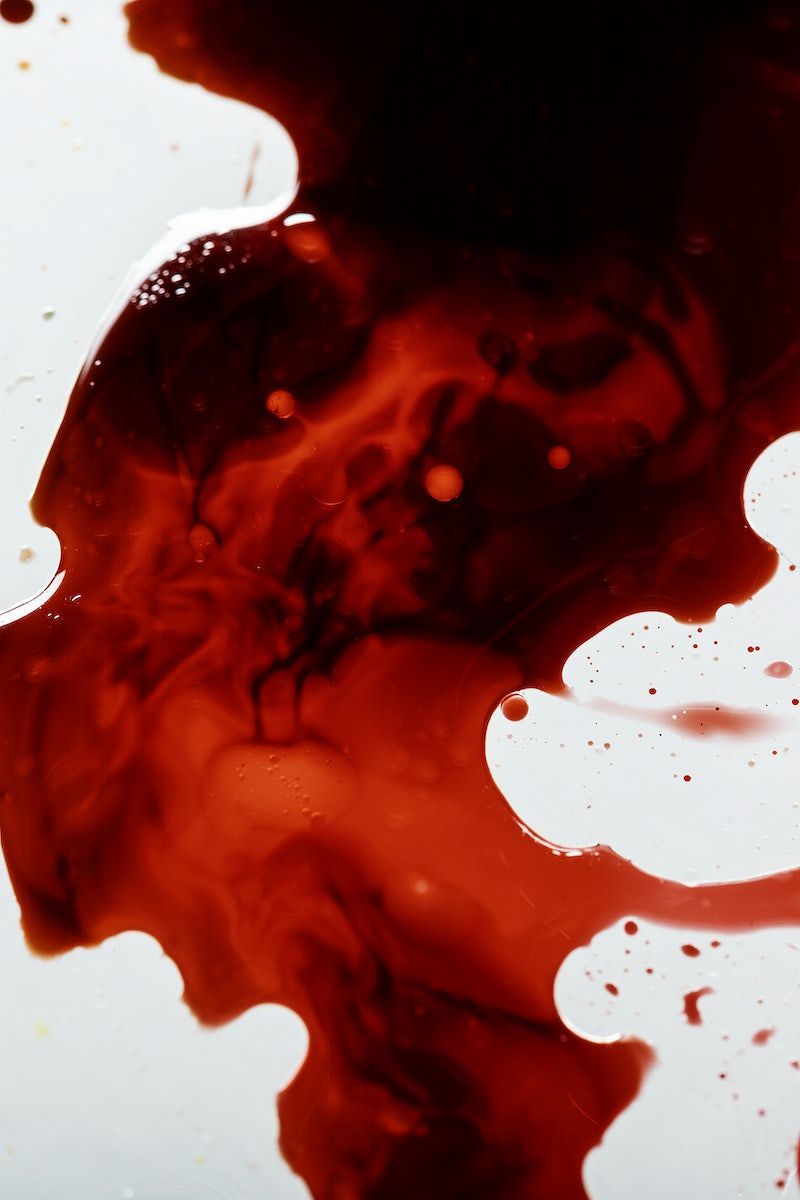 A close up of a pool of blood on a white surface. - Blood